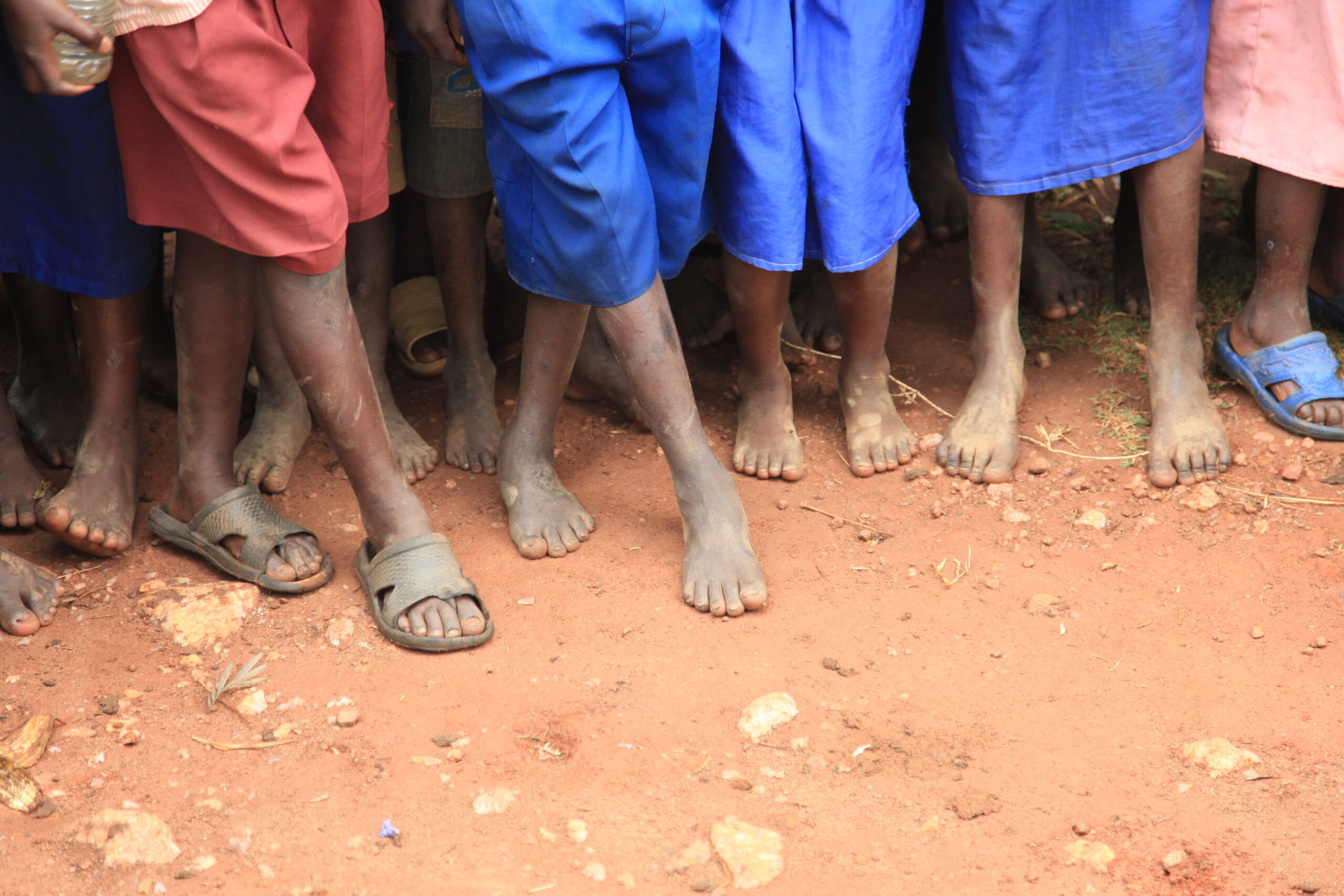 The Feet of Children Living in Poverty in Uganda, Africa